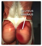Beverly Hills Chiropractic--gluteus maximus